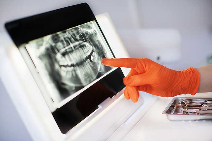 Advanced Technology 1 dental x-ray