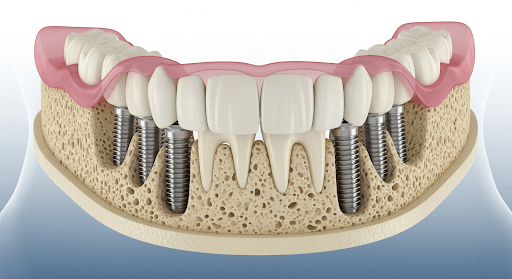 Prestige Family Dentistry And Kidzone Dental