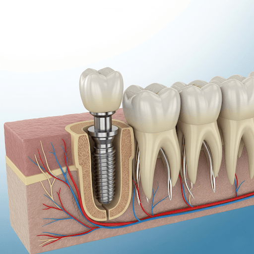Prestige Family Dentistry And Kidzone Dental