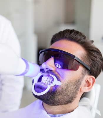 Cosmetic Dentistry Options for Adults with Busy Lifestyles 1 Professional Teeth Whitening