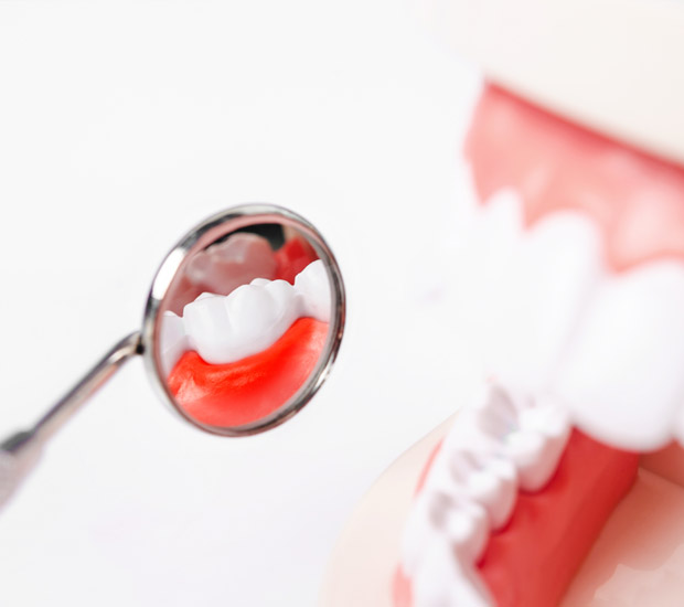 Houston Periodontal Probing